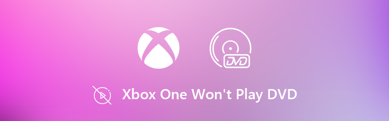 Xbox OneでDVDを再生できない